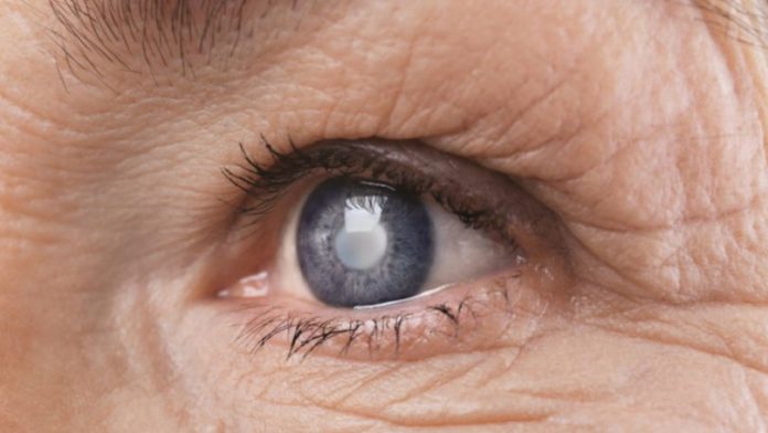 mati-glafkoma-eyes