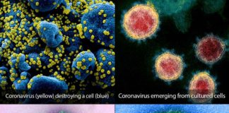 Κορωνοϊός: Νεκρή μια 90χρονη – 53 τα θύματα covid-19-coronavirus