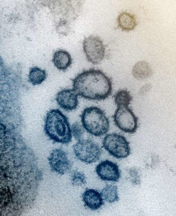 covid-19-coronavirus1