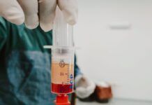 Πλασμαφαίρεση: Η σύνθετη ιατρική πράξη που βρέθηκε στο επίκεντρο – Τι προβλέπει ο νόμος και γιατί απαιτεί ειδικές δομές